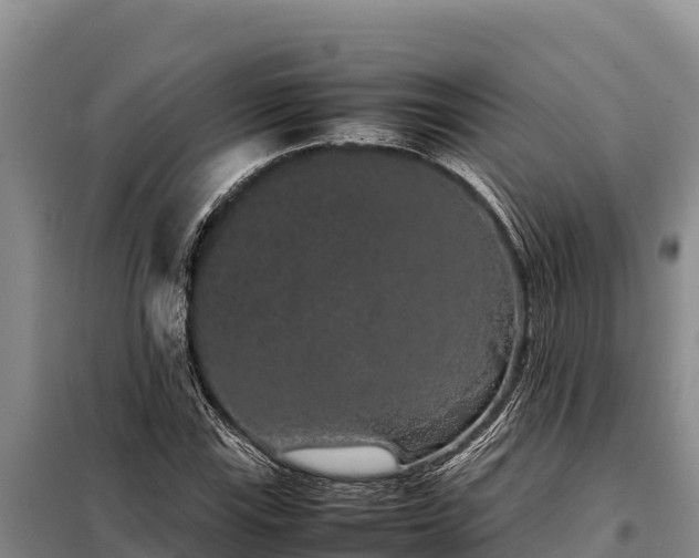 X0000099311115200805091011