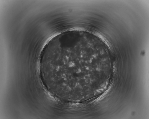 X0000099311117200805091011