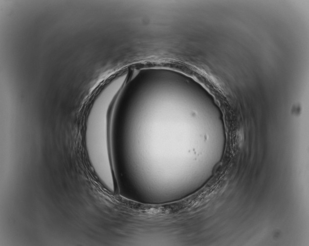 X0000099311160200805091011