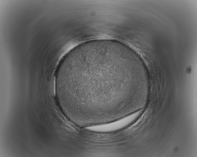 X0000099311171200805091011