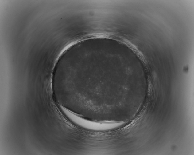 X0000099311174200805091011