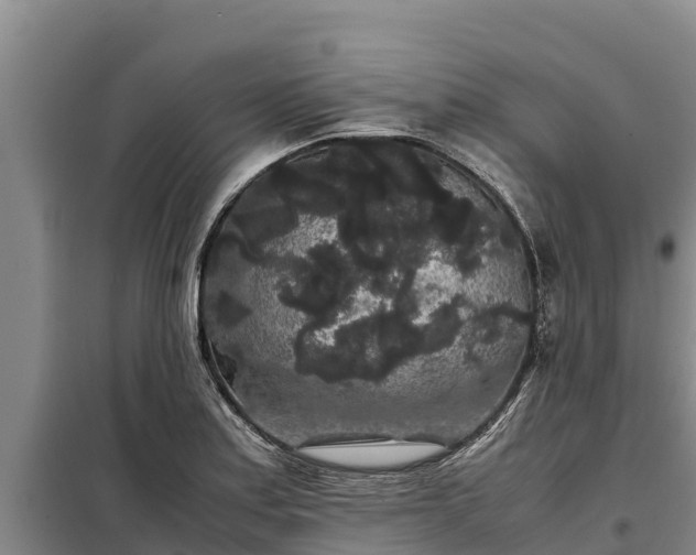 X0000099311179200805091010
