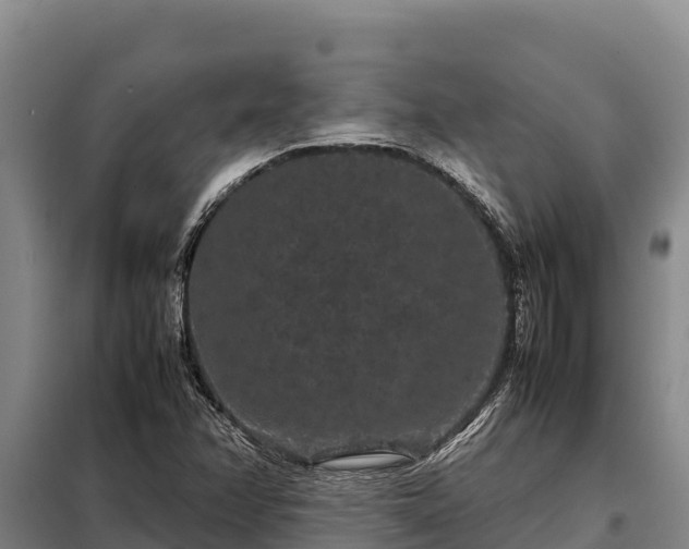 X0000099311358200805091008