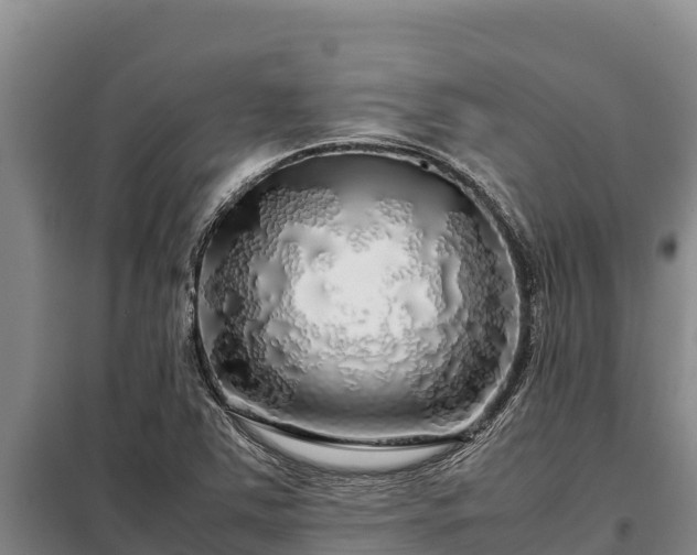 X0000099311363200805091008