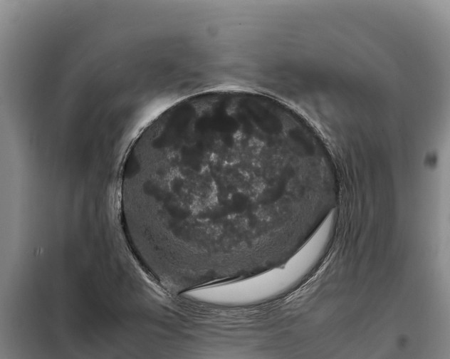 X0000099311367200805091008