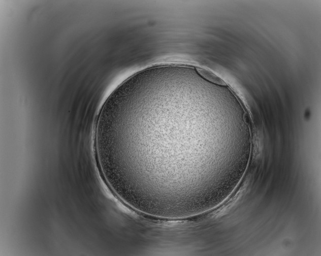 X0000099311390200805091007