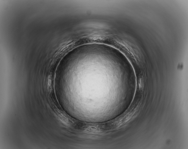 X0000099311396200805091007