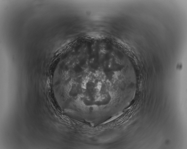 X0000099311397200805091007