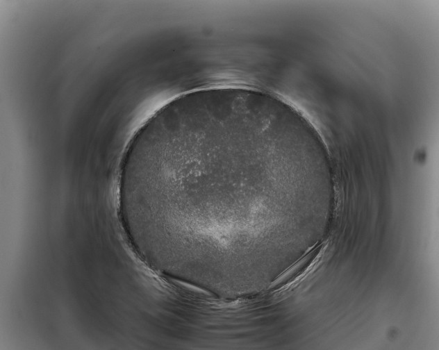 X0000099311415200805091007