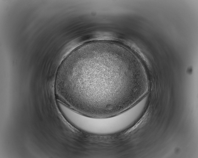 X0000099311417200805091007