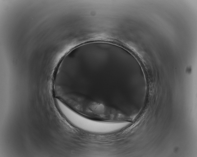 X0000099311463200805091006