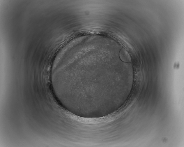 X0000099310030200805161423