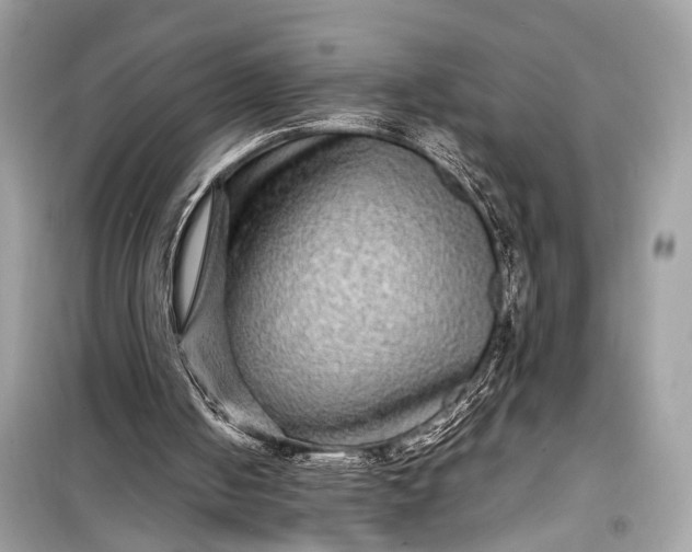 X0000099310050200805161422