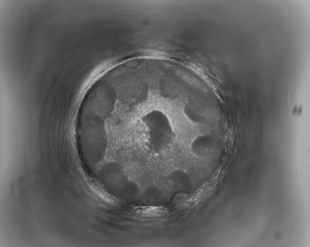 X0000099310151200805161421