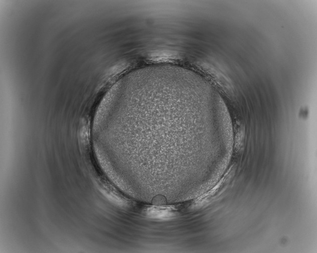 X0000099310179200805161421