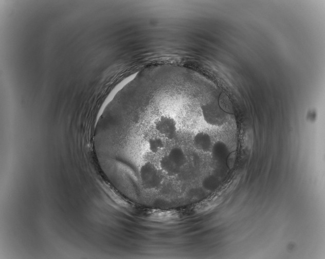 X0000099310185200805161421