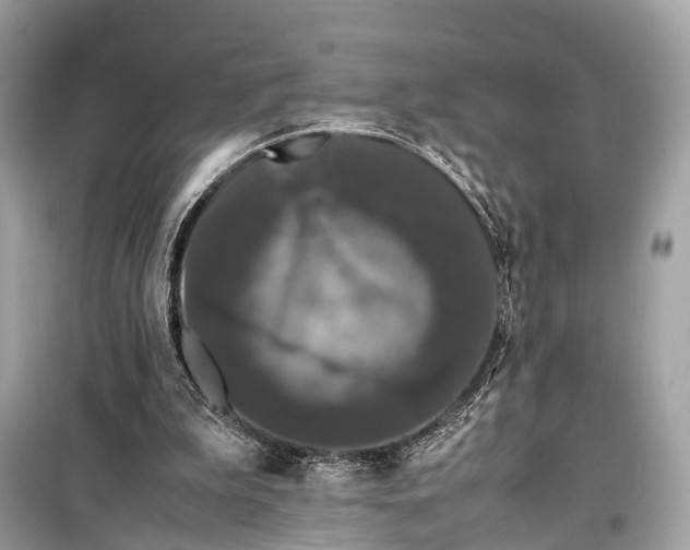 X0000099310199200805161421