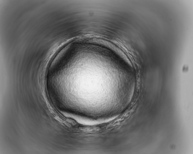 X0000099310241200805161419