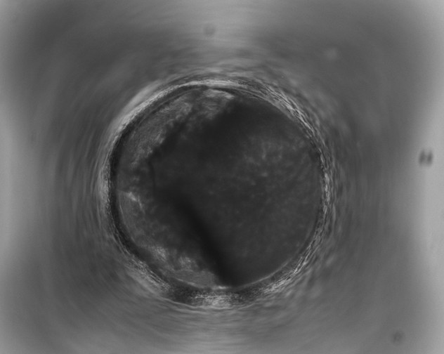 X0000099310295200805161419