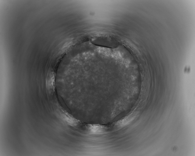 X0000099310336200805161419