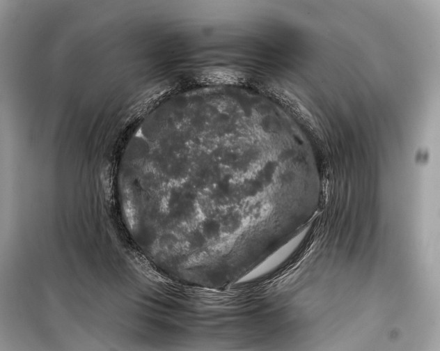 X0000099310359200805161418