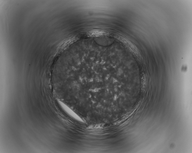 X0000099310361200805161418