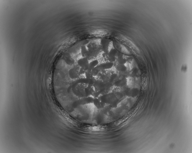 X0000099310365200805161418