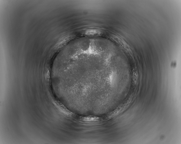 X0000099310375200805161419