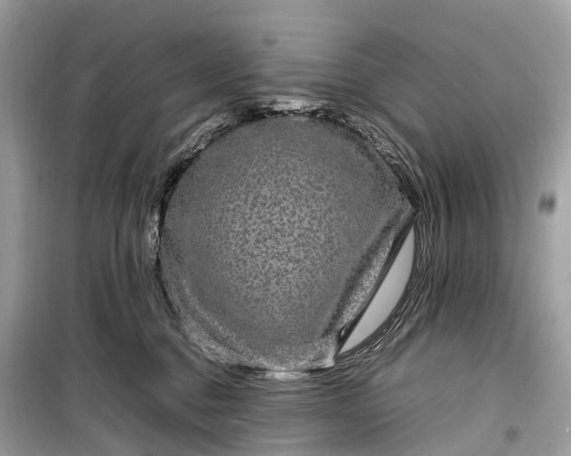 X0000099310376200805161419