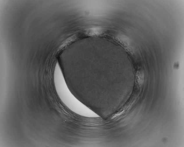 X0000099310380200805161419