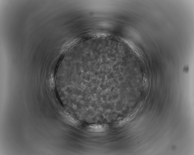 X0000099310381200805161419