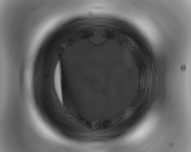 X0000099310383200805161419