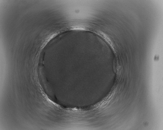 X0000099310385200805161418