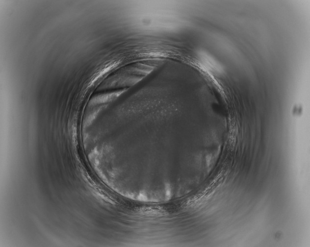 X0000099310386200805161418