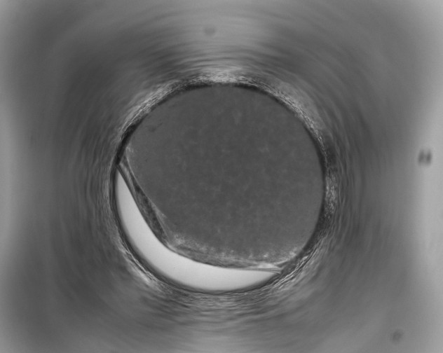 X0000099310397200805161418