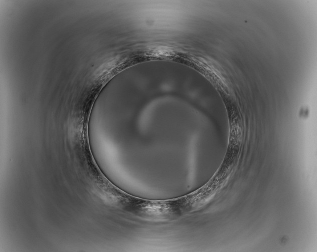 X0000099310415200805161418