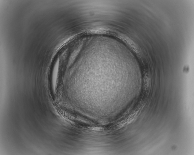 X0000099310446200805161417