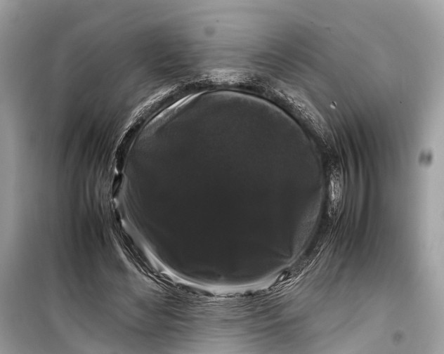 X0000099310492200805161416