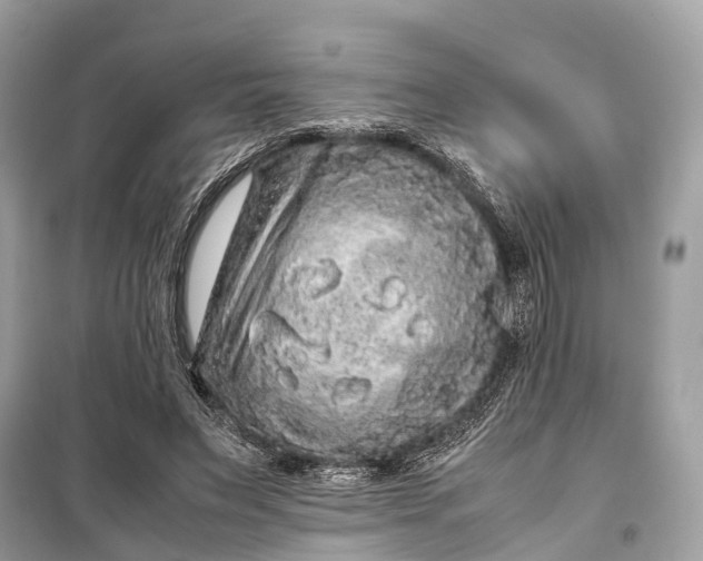 X0000099310495200805161416