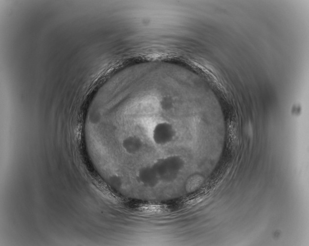 X0000099310499200805161416