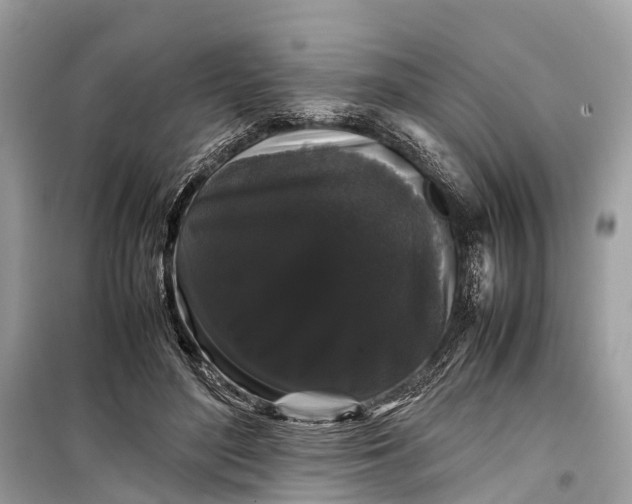 X0000099310500200805161416