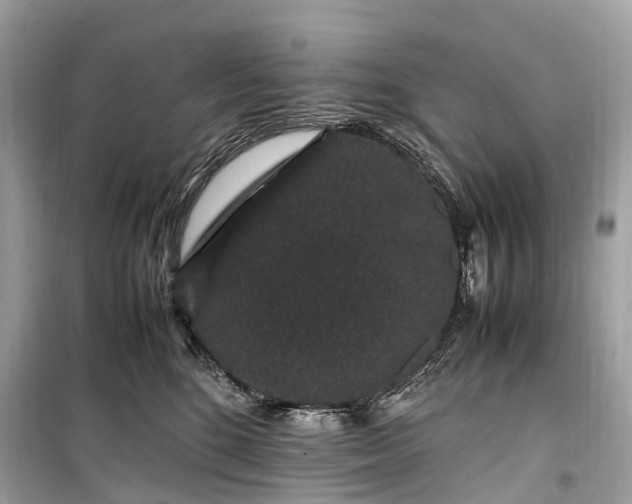 X0000099310520200805161416