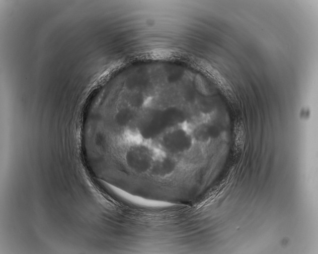 X0000099310542200805161415