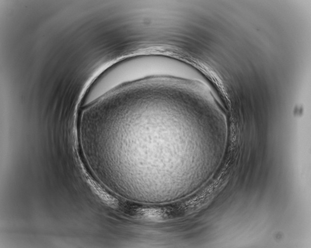 X0000099310792200805161412