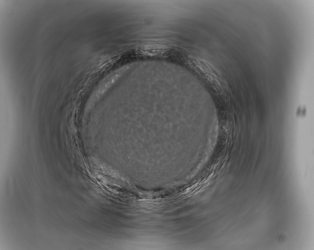 X0000099310817200805161410