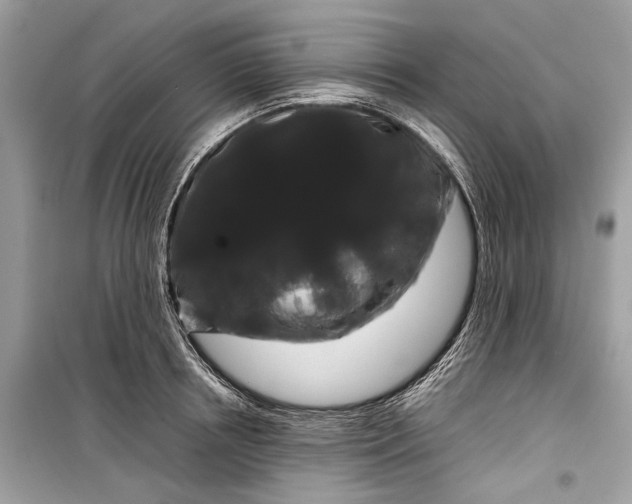 X0000099310850200805161411