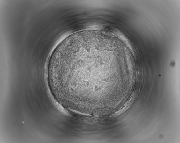 X0000099310859200805161411