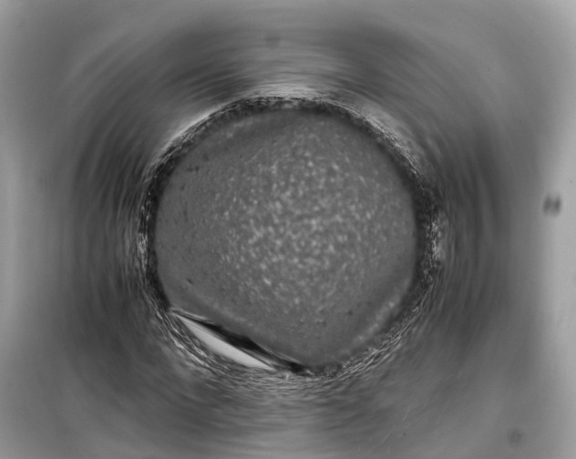 X0000099310872200805161410