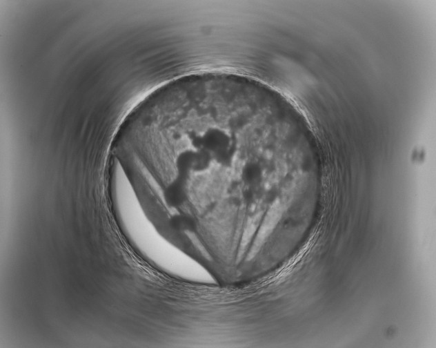 X0000099310879200805161410