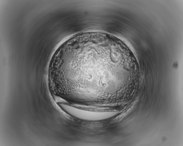 X0000099310957200805161410